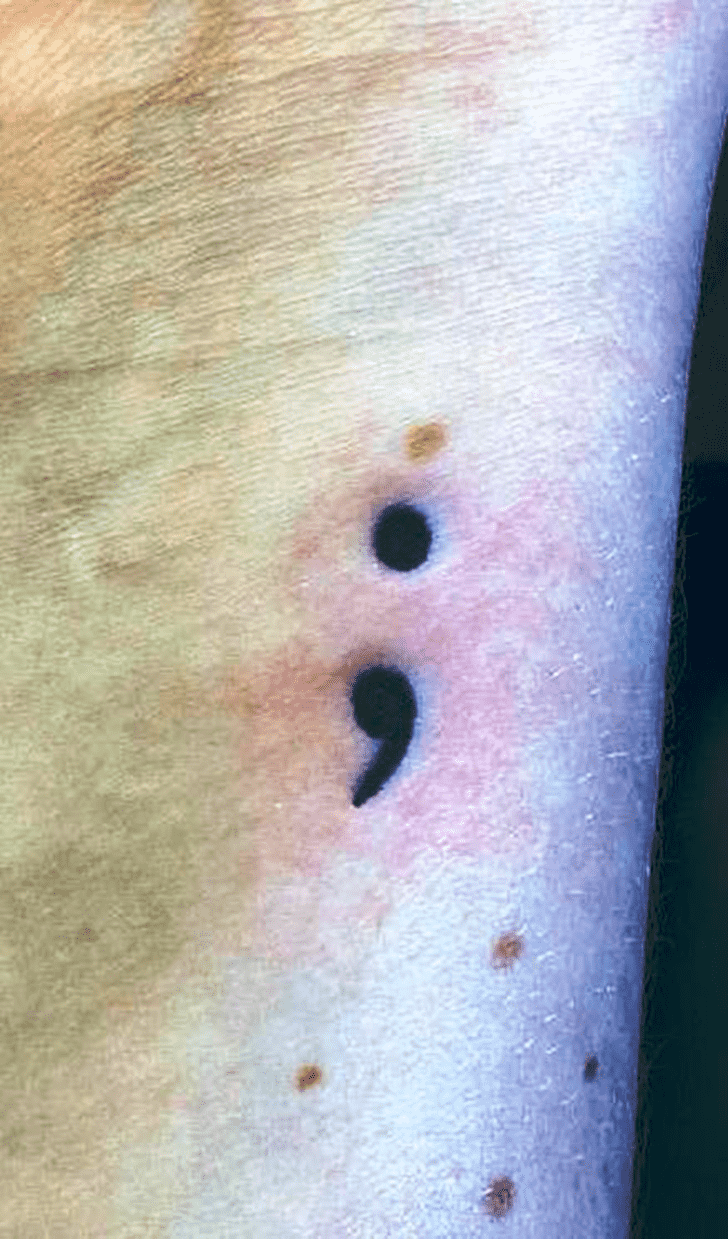 Semicolon Tattoo Photo